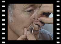 Akupunktur in der täglichen Praxis, Teil 1-3