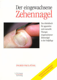 Der eingewachsene Zehennagel